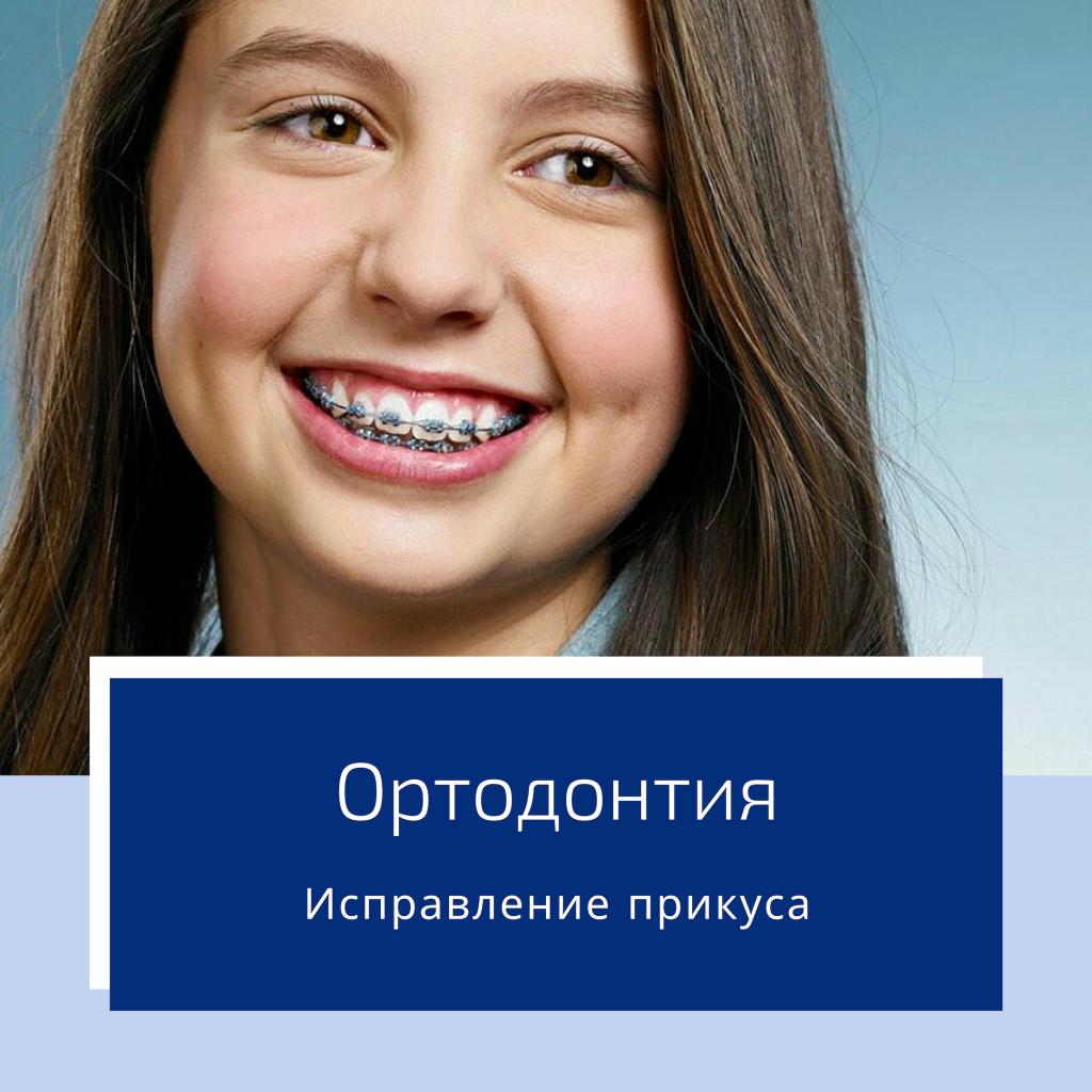 Исправление прикуса у детей и взрослых