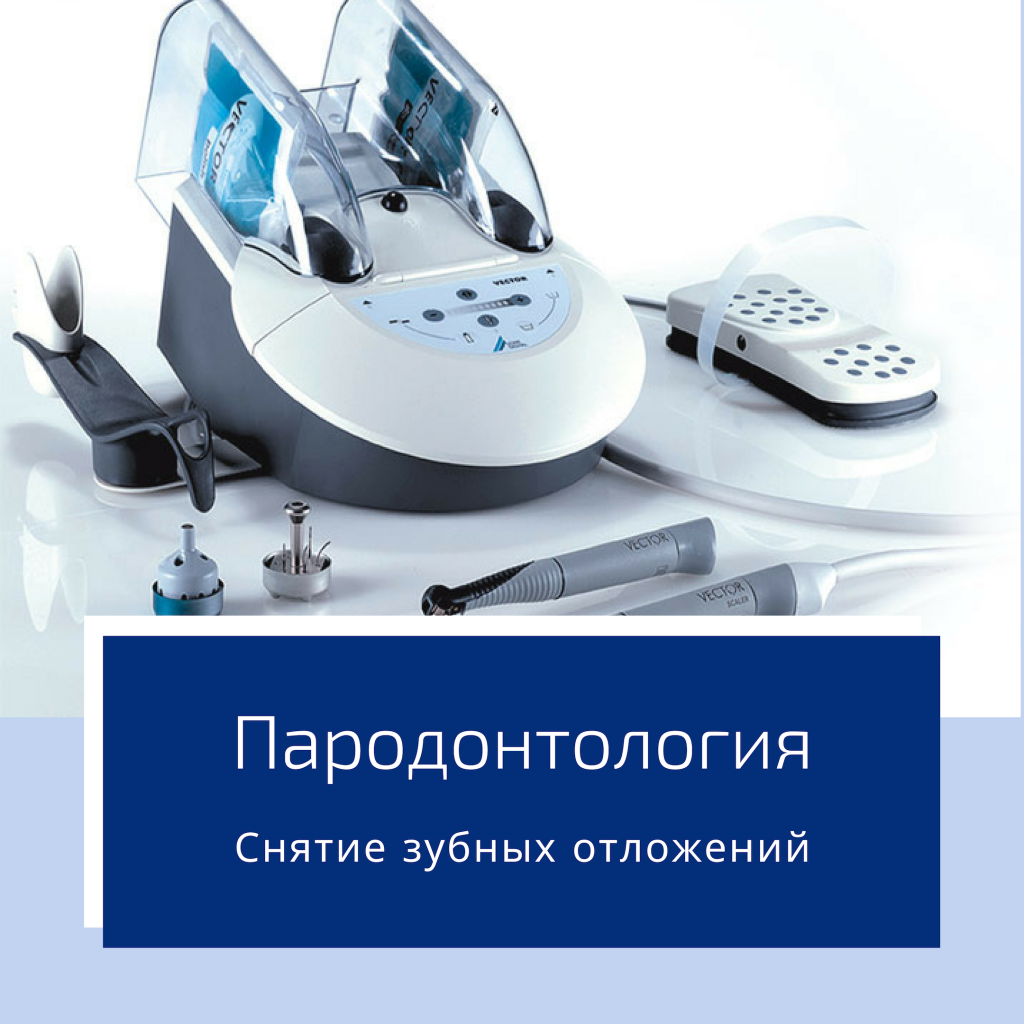 Снятие зубных отложений